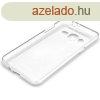 Microsoft Lumia 435 tltsz vkony szilikon tok