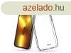 Roar All Day Full 360 szilikon tok - Xiaomi Redmi Note 14 Pr