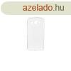 Honor Magic 7 Pro tltsz vkony szilikon tok