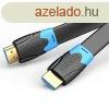Vention Flat HDMI A male - HDMI A male cable 2m Black