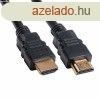 BLACKBIRD Kbel HDMI male/male sszekt 2K 1m, Fekete